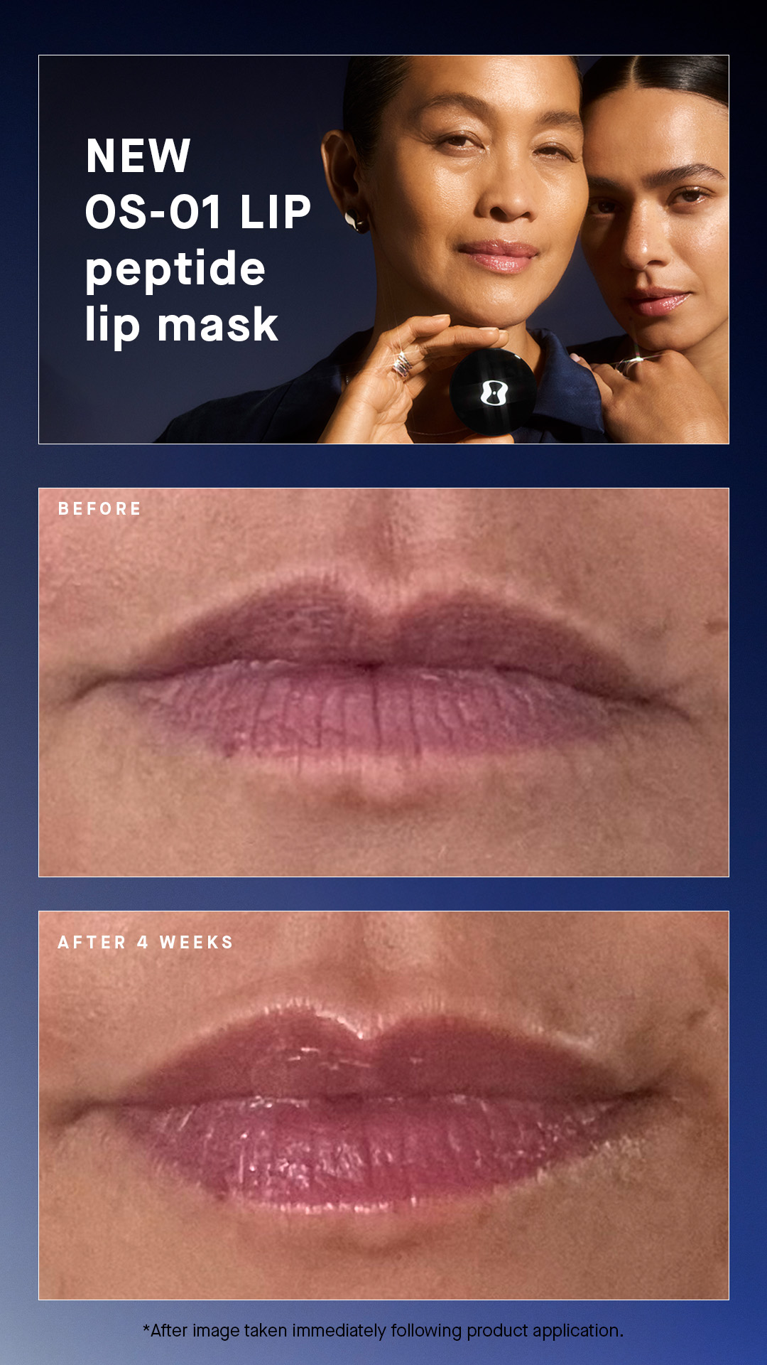OneSkin Facebook ad
