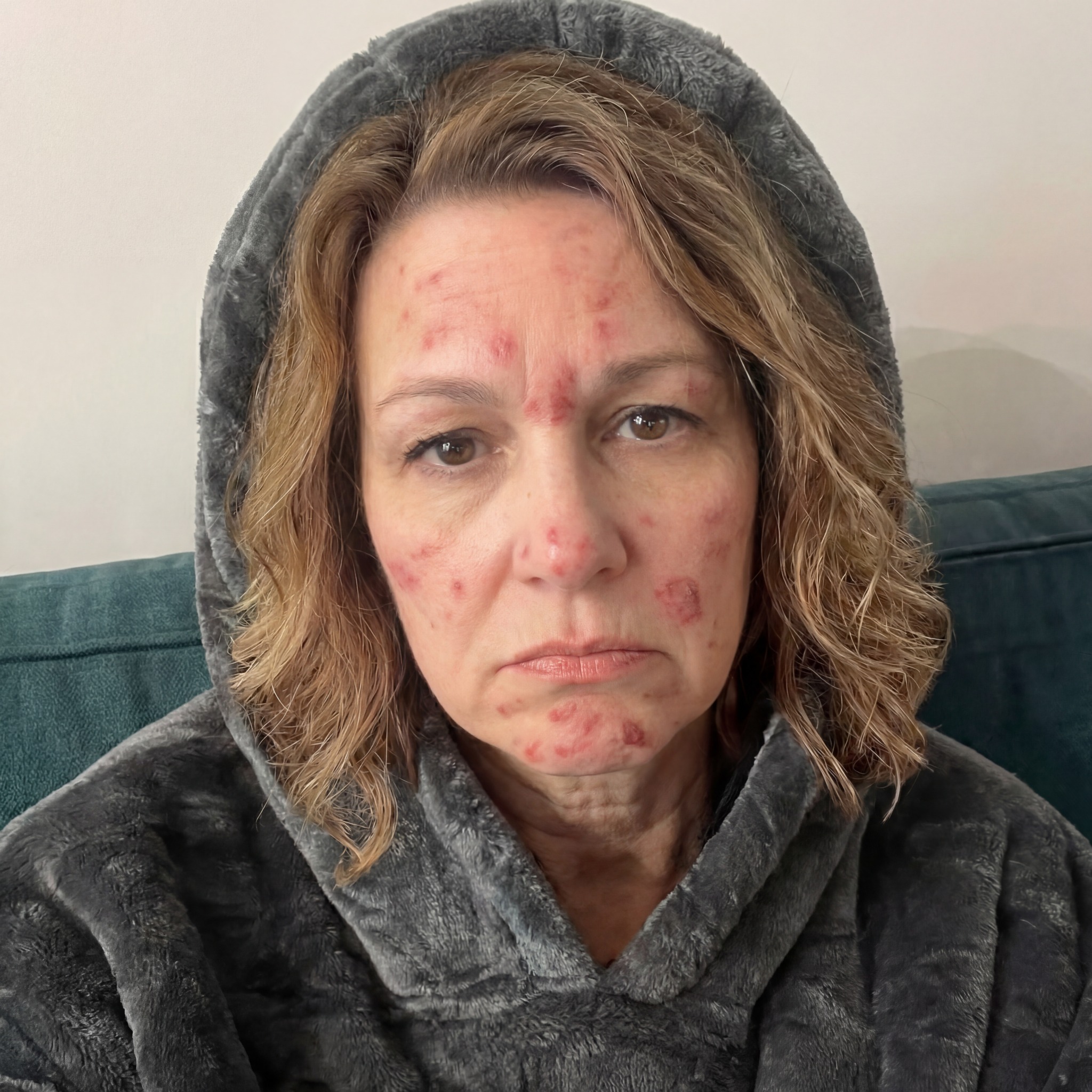 Joanne Robertson Facebook ad: Read This If ADHD Has You Picking Non-Stop