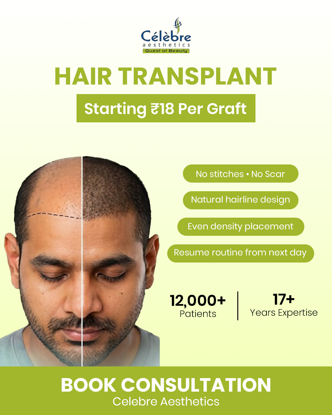 Celebre Aesthetics Facebook ad: Hair loss doesn't just take your hair.