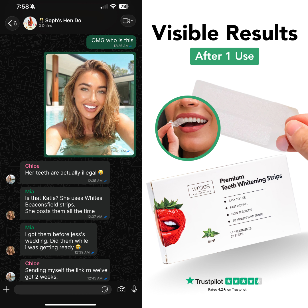 Whites Beaconsfield Facebook ad: Affordable Teeth Whitening