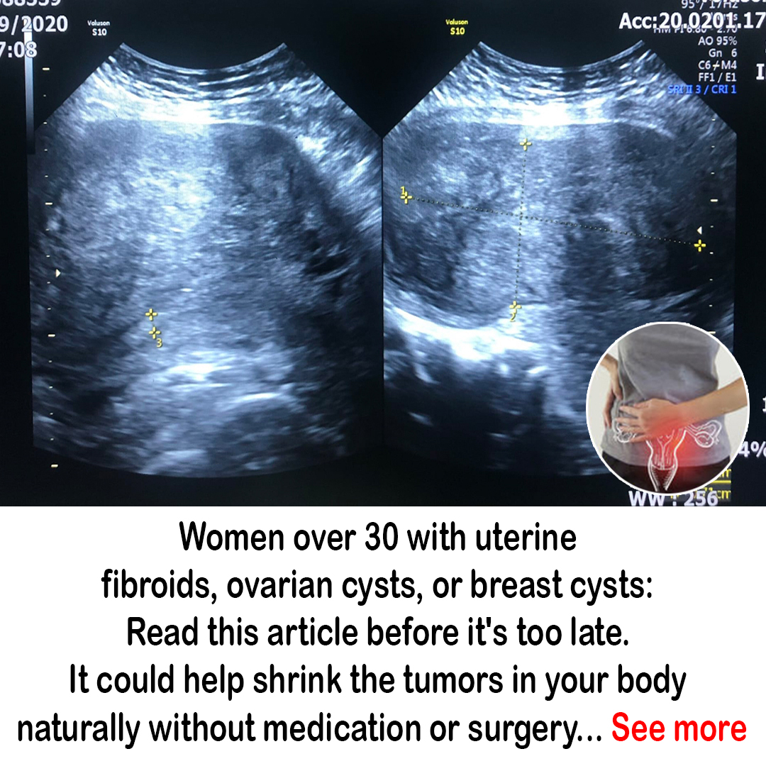 Teacher maria Facebook ad: Read and follow your doctor's instructions.