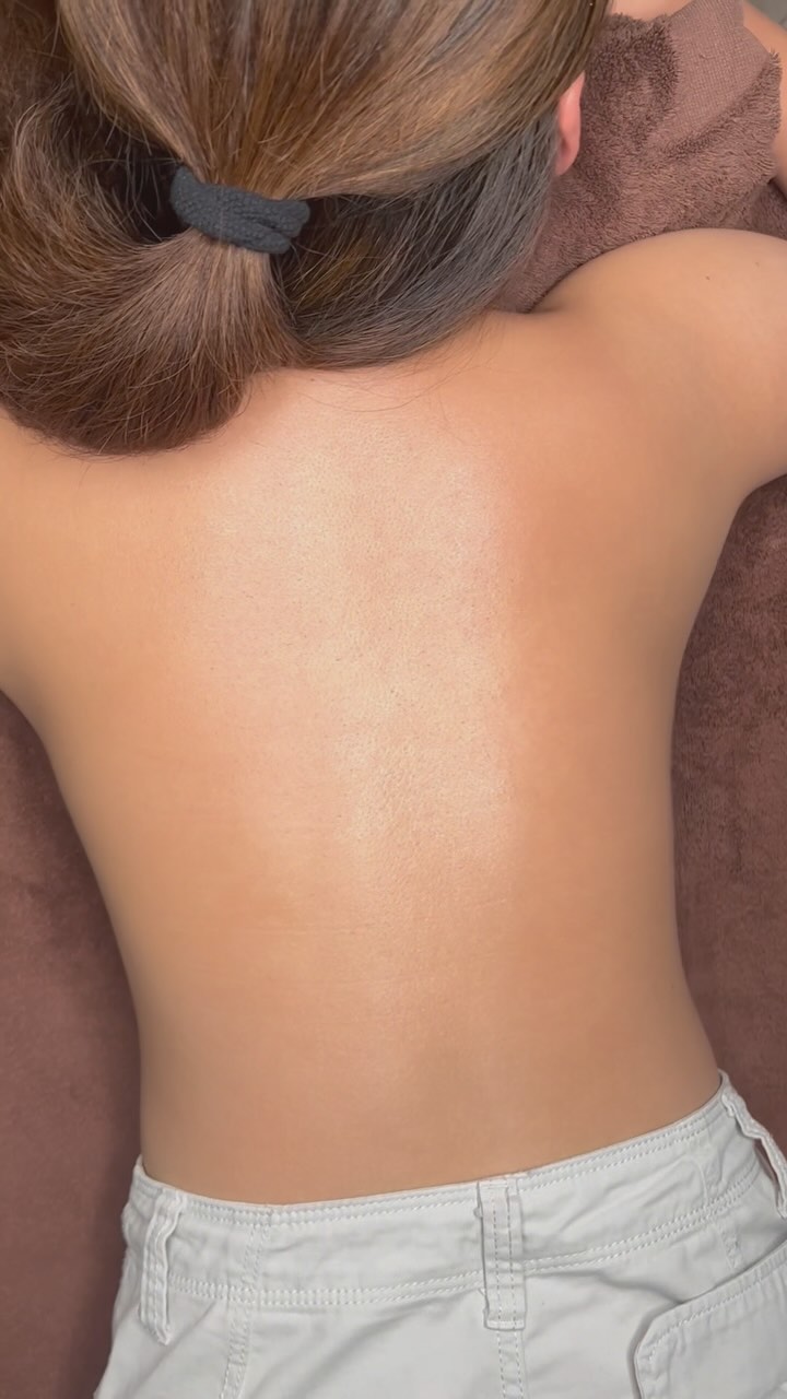 Sydney Dermal Lounge Revesby Facebook ad: GLASS BACK Dermal specialist @claudiaalorenzatto