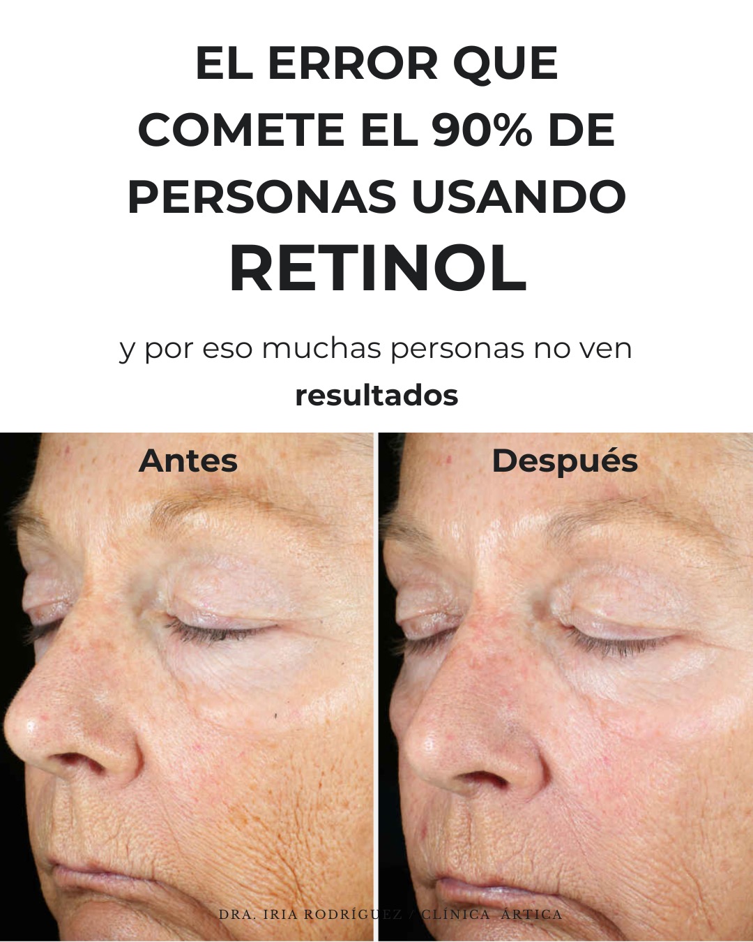 Ártica Medicina Estética Facebook ad: Muchas personas usan retinol… pero cometen siempre el…