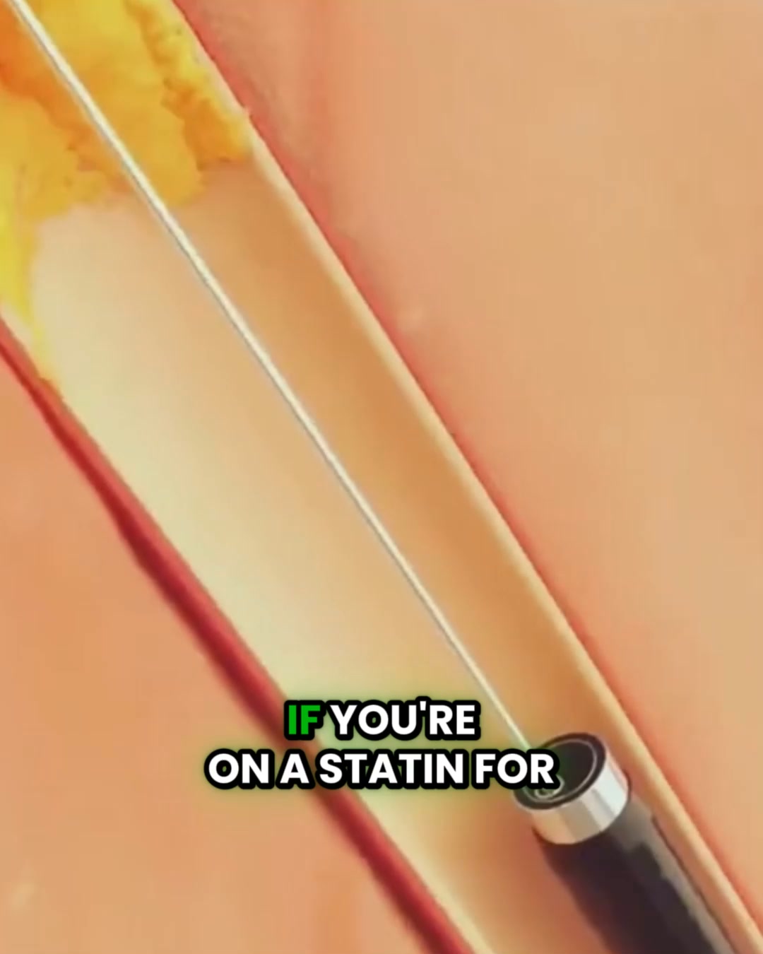 Inner Dose Facebook ad: Support BP & Cholesterol Naturally