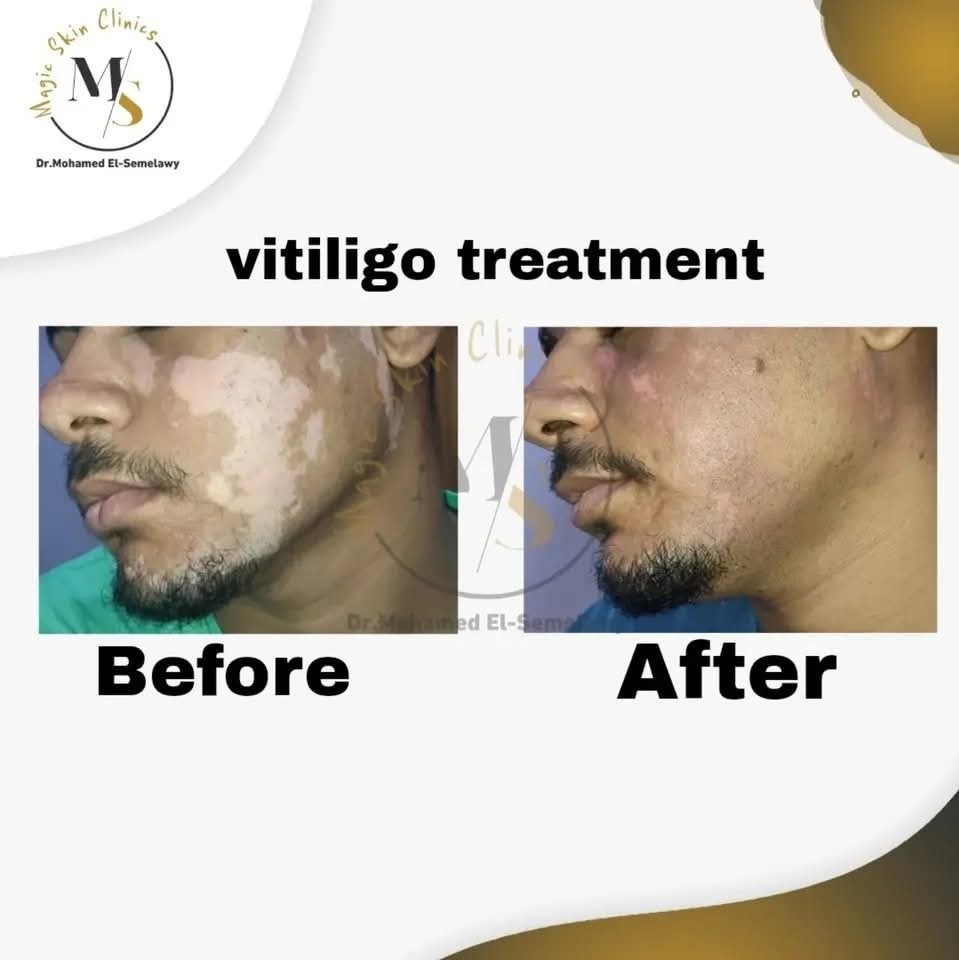 Magic skin clinics Facebook ad
