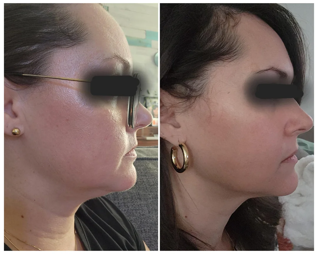 Dr. Christi Thompson Facebook ad
