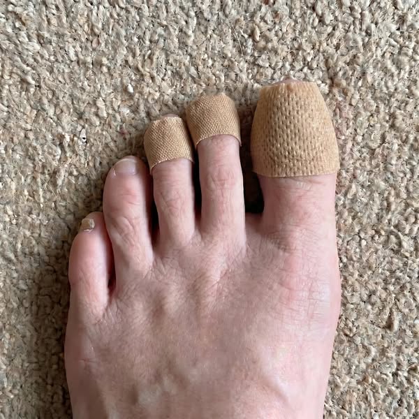 Sarah Mitchell Facebook ad: Doctor Secret About Nail Fungus You Didn't Know About