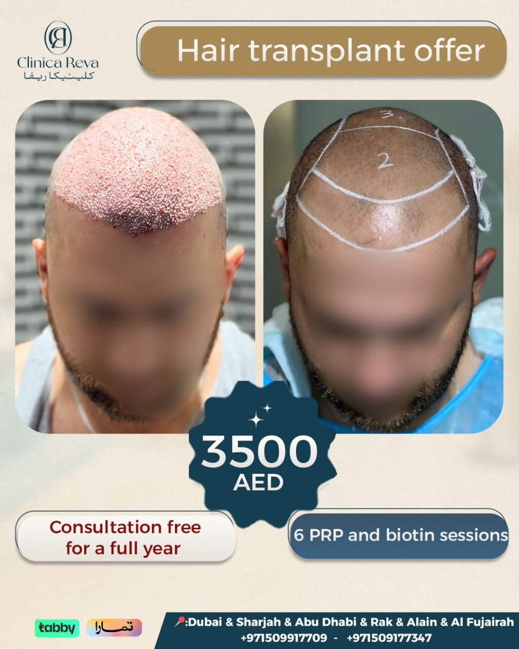 Clinica Reva  Facebook ad