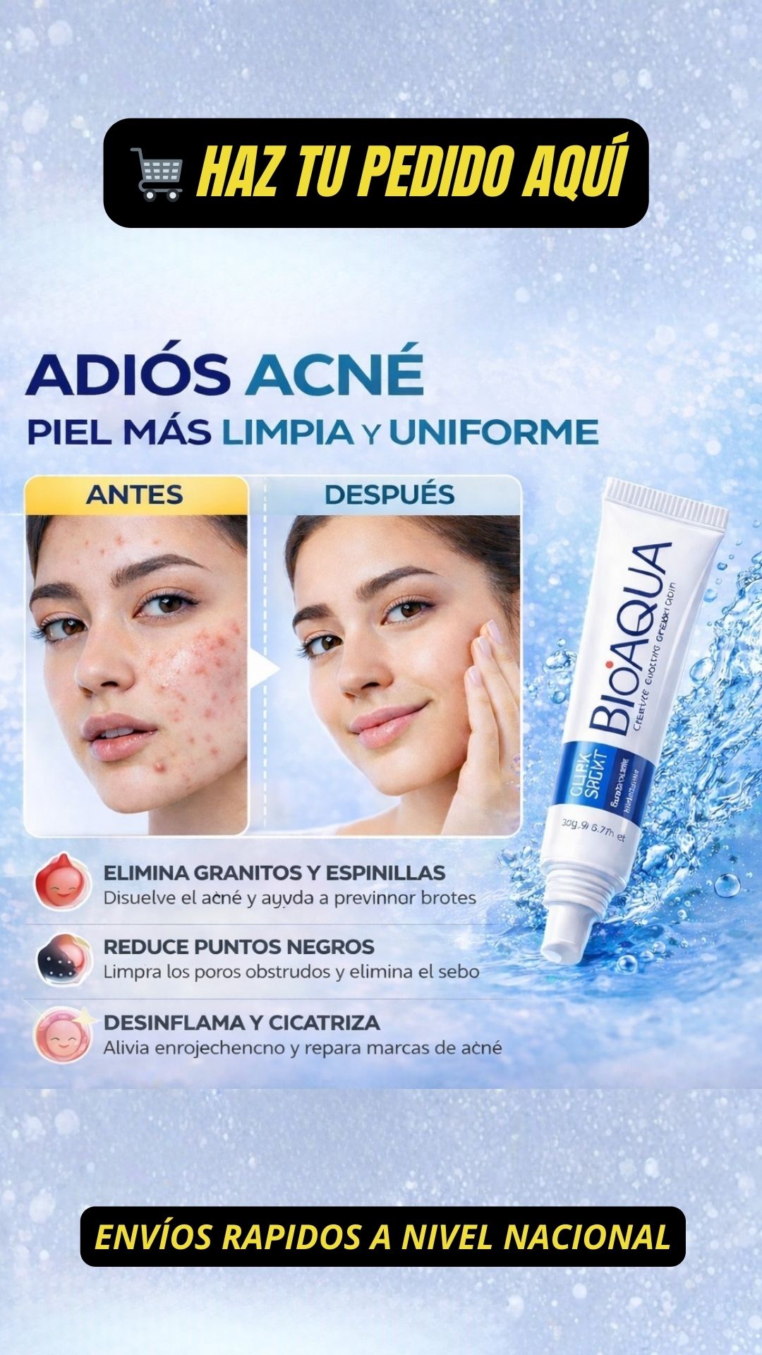 Loverssa Facebook ad: Adiós Acné
