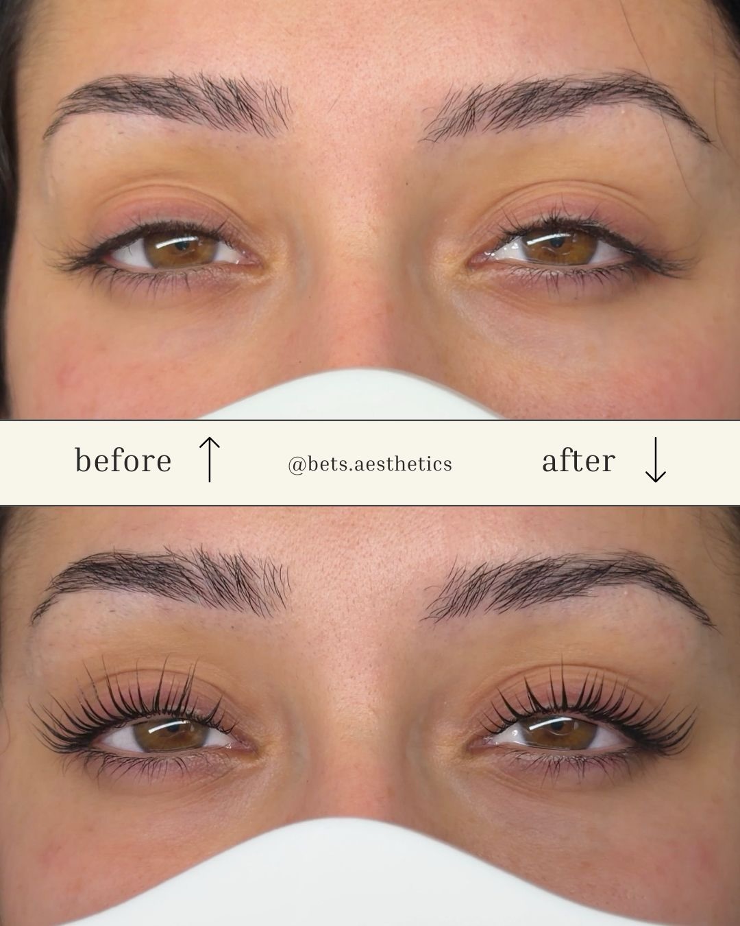 Anaslife Facebook ad: Soft, lifted, and effortlessly clean