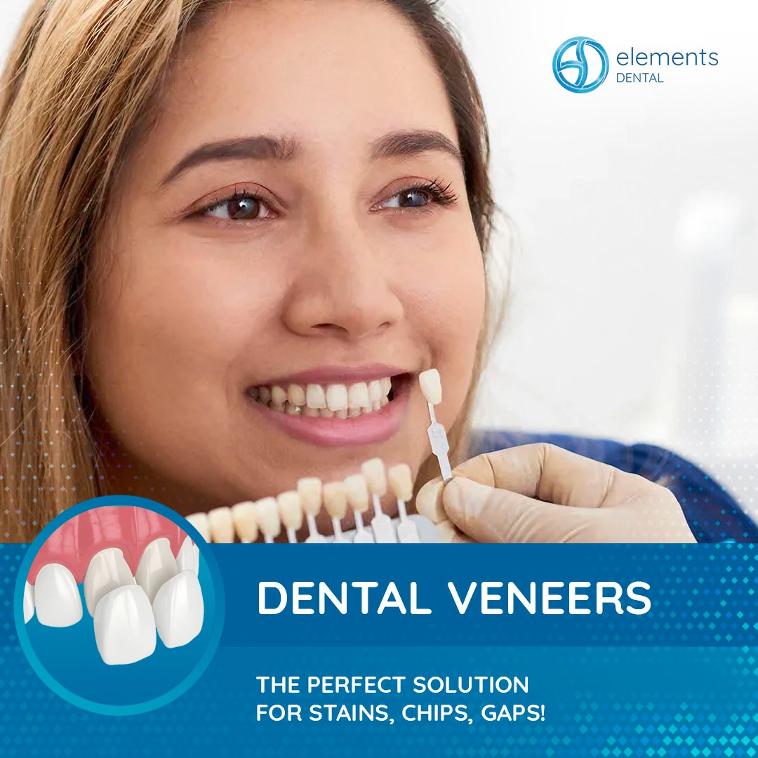 Elements Dental Facebook ad from Dec 9, 2025