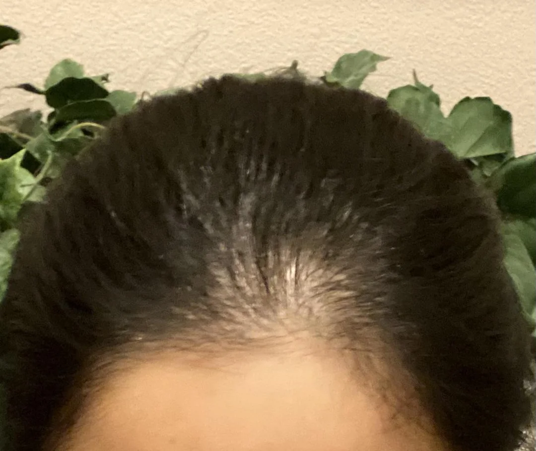 Hair Solutions Facebook ad
