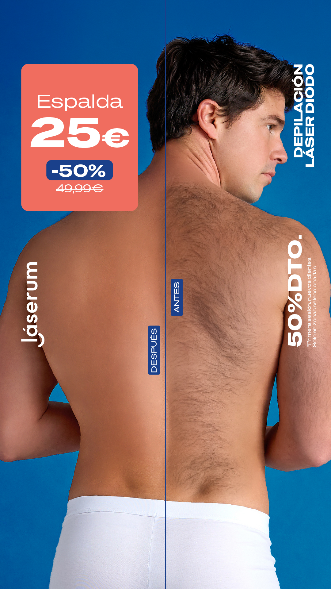 Láserum Facebook ad