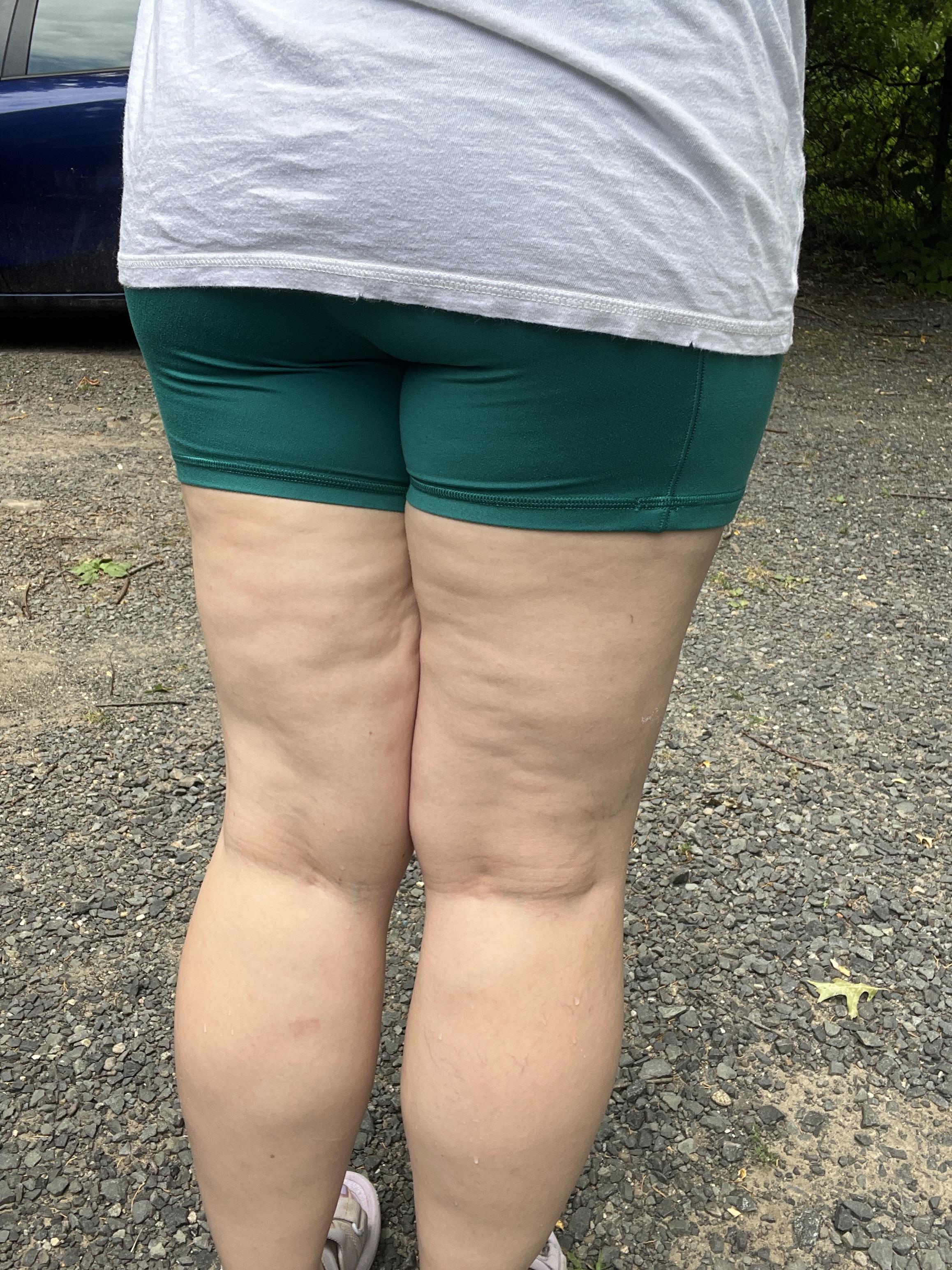 Diane Hollis - Herbalist Facebook ad: If your shoes feel tight by 3pm, your face is puffy in the…