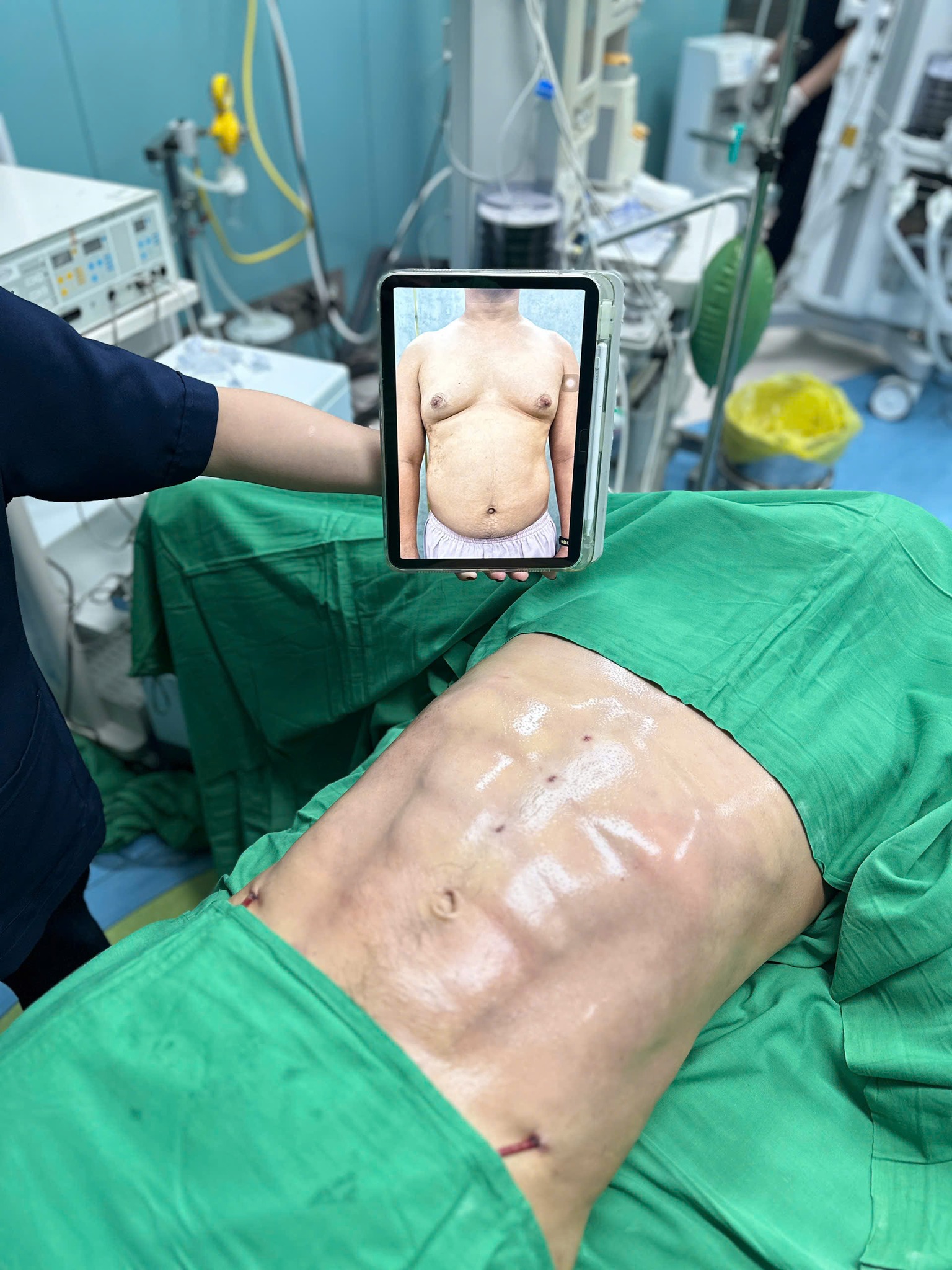 Cosmetic Surgery 5 Star Hospital Facebook ad: Abdominal liposuction, sculpting a six-pack body.