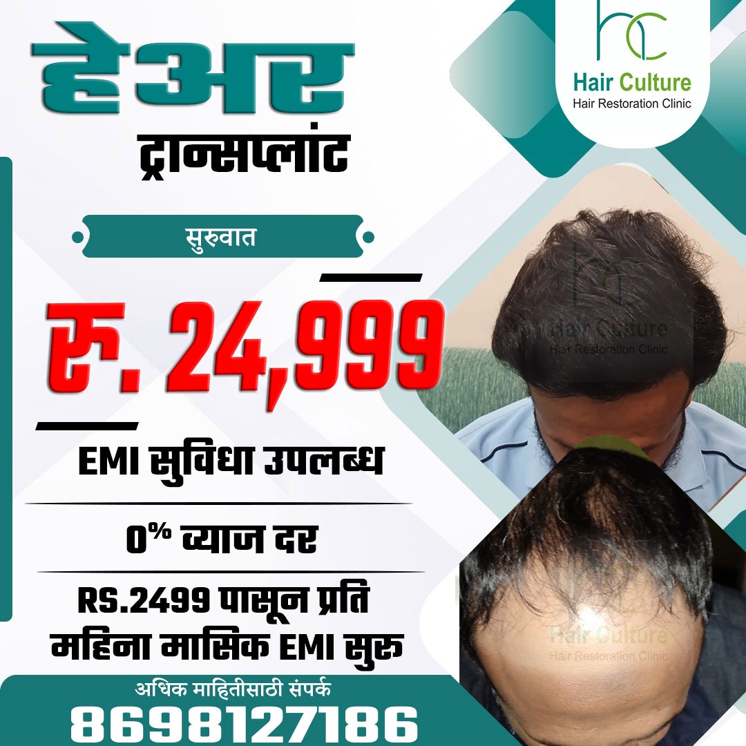 Hair Culture Facebook ad: Hair Transplant Starting @ ₹24,999