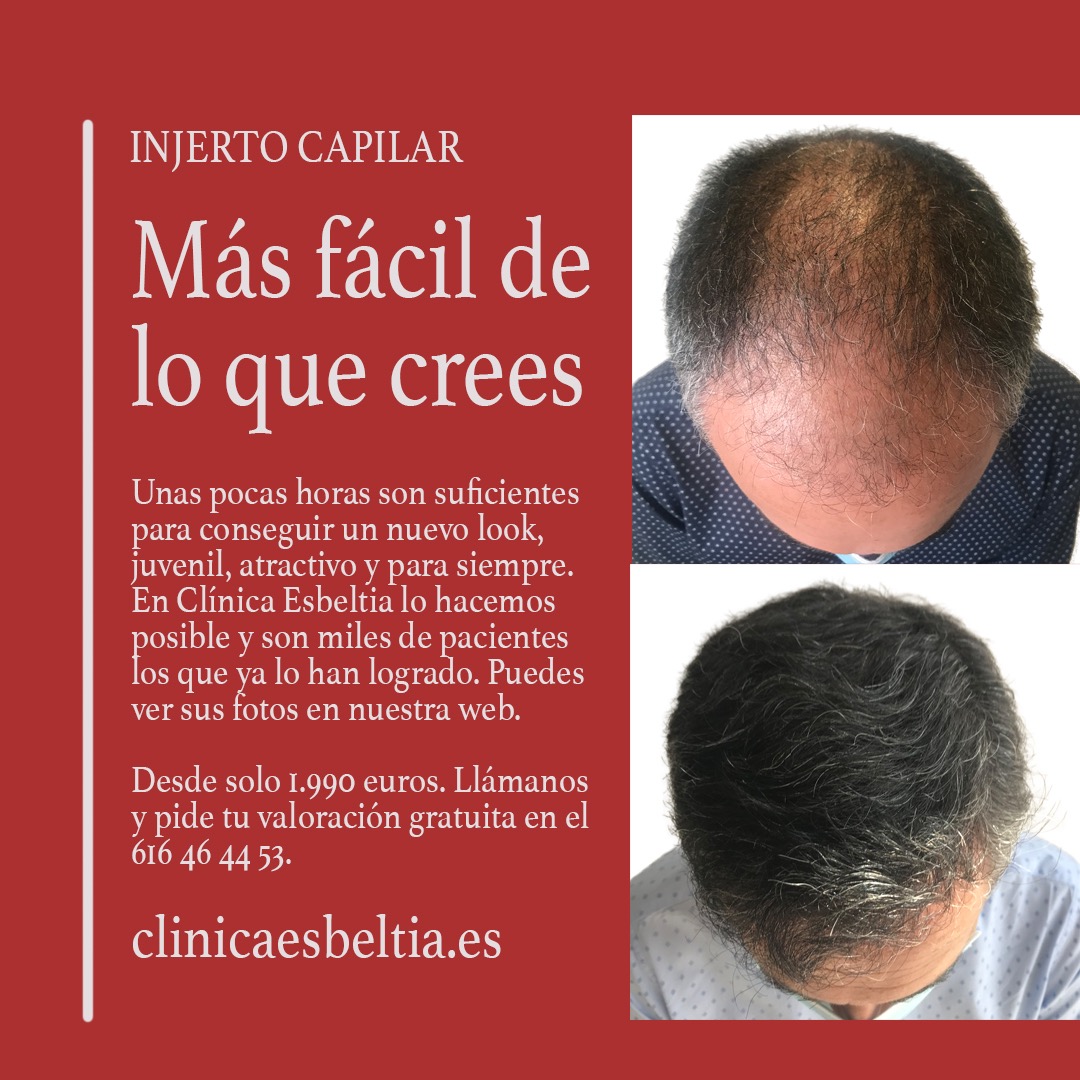 Clínica Esbeltia Facebook ad