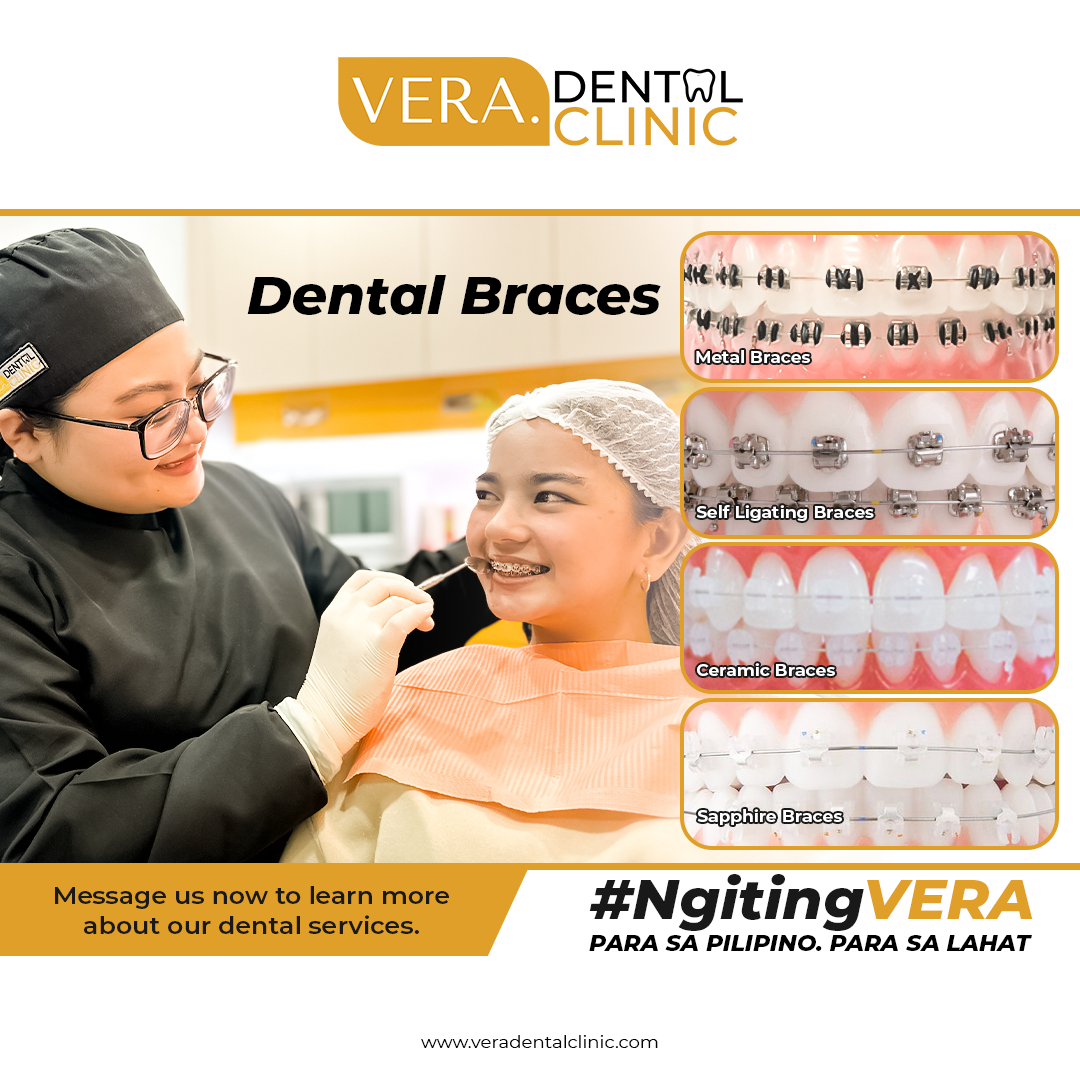 VERA. Dental Clinic - Unitop Dasmariñas Facebook ad