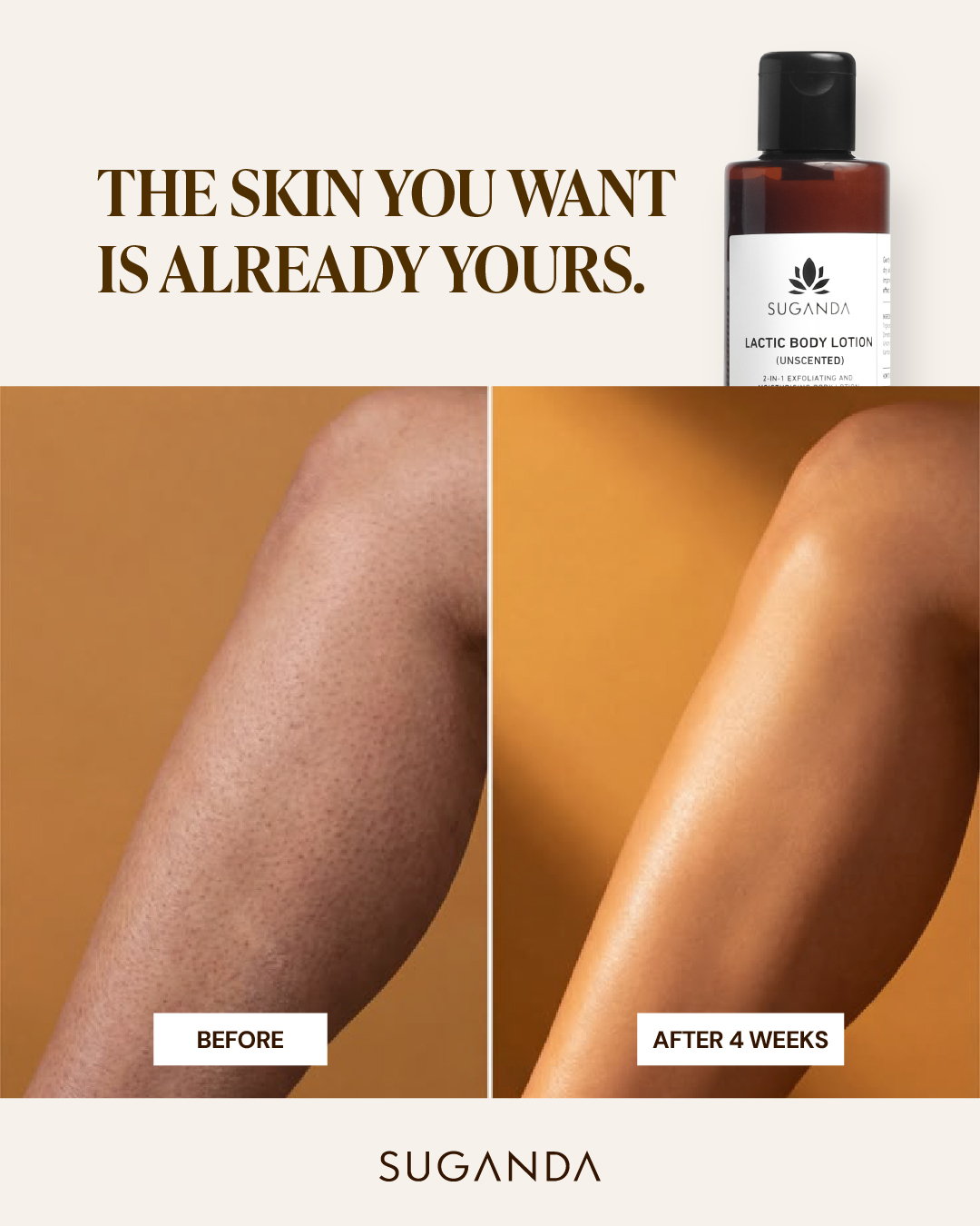 Suganda Skincare Facebook ad