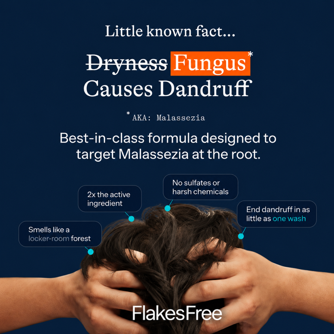 Keshya Ceylon Facebook ad: End Dandruff Forever.