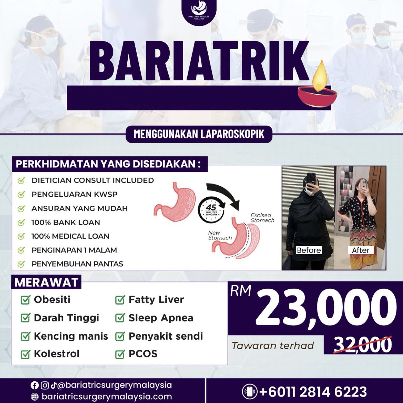 Bariatric Surgery Facebook ad: Free Consultation