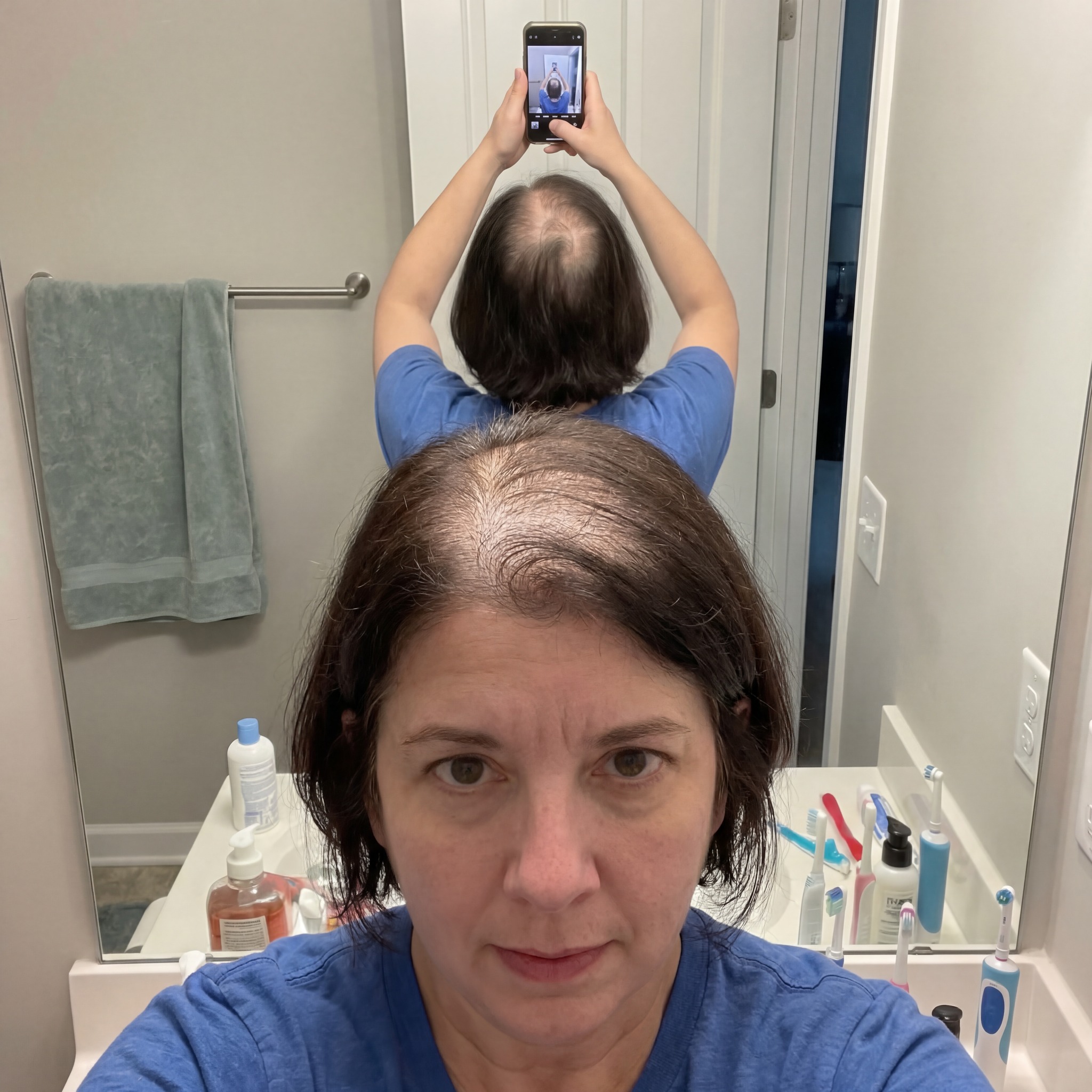 Laurie Hayes Facebook ad: What Saved My Hair From Falling Out