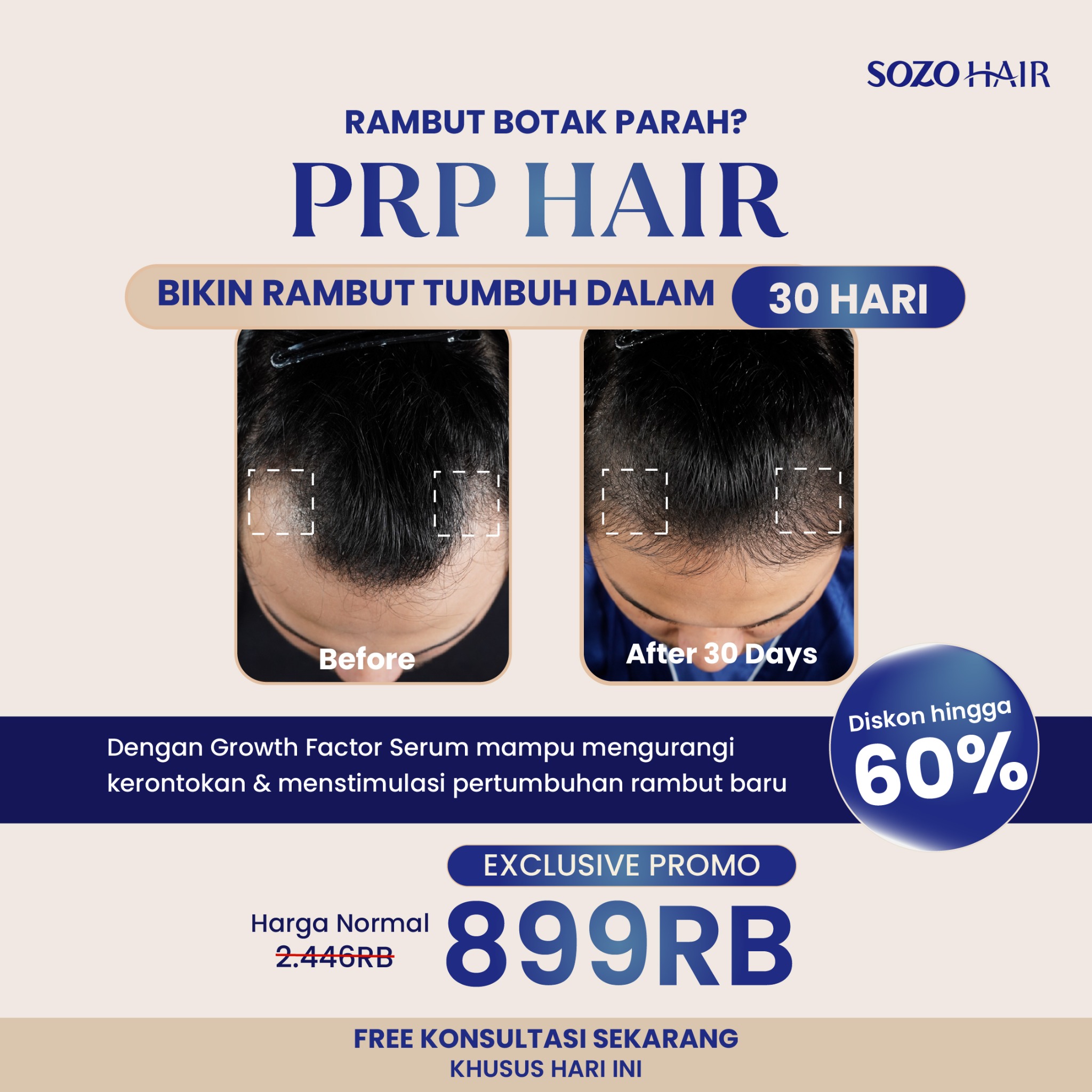 SOZO Hair Science Facebook ad