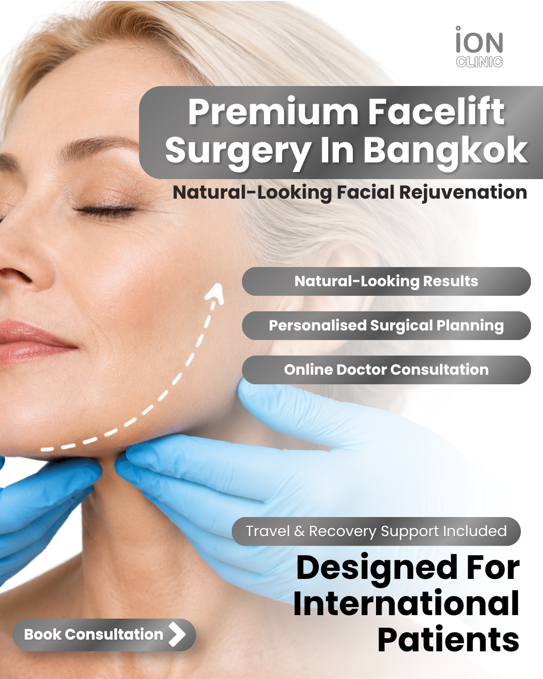 ION Clinic Bangkok Facebook ad