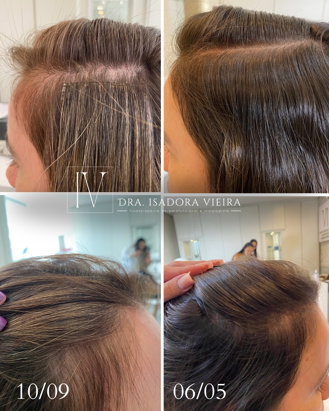 Dra Isadora Vieira Facebook ad: Será que o uso de Megahair é realmente…