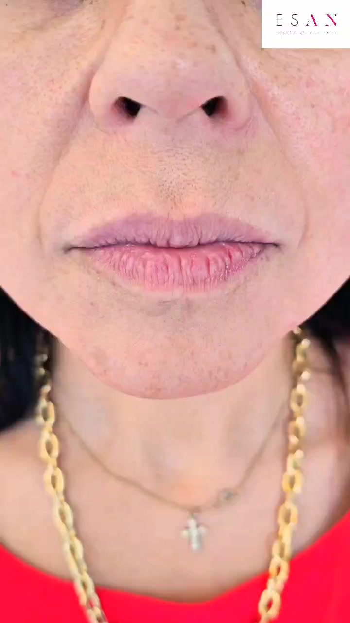 Clínica Esan Facebook ad: Transforma tu sonrisa con expertos en Clínica Esan