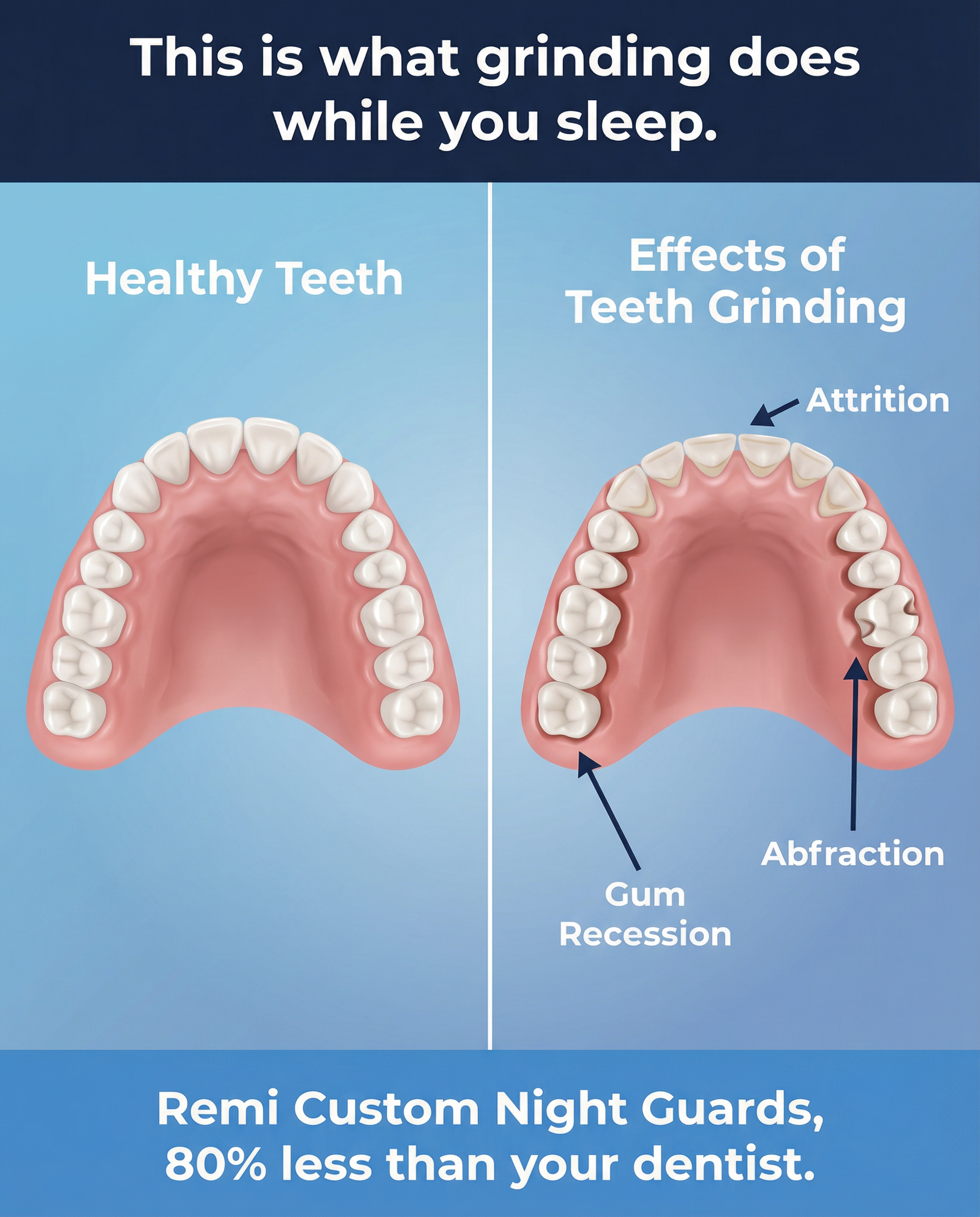 Remi Wellness Facebook ad: Stop the Morning Headaches