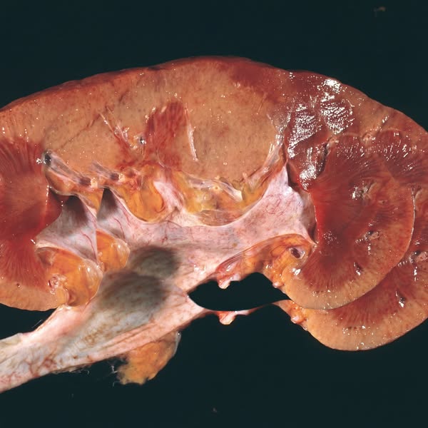 Dr. Tasha Reynolds - Nephrologist, MD Facebook ad: Your Kidneys Aren't Failing. They're Suffocating.