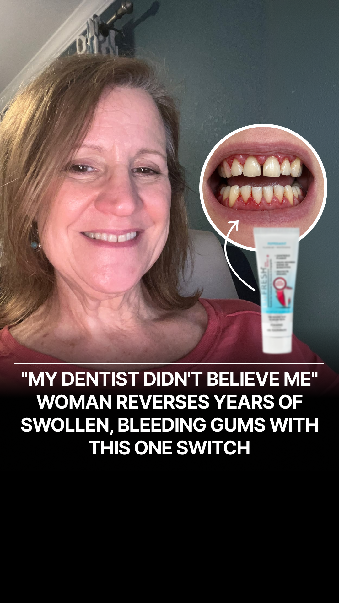 LIVFRESH Facebook ad: If Your Gums Bleed When You Brush or Floss, This Was Made…