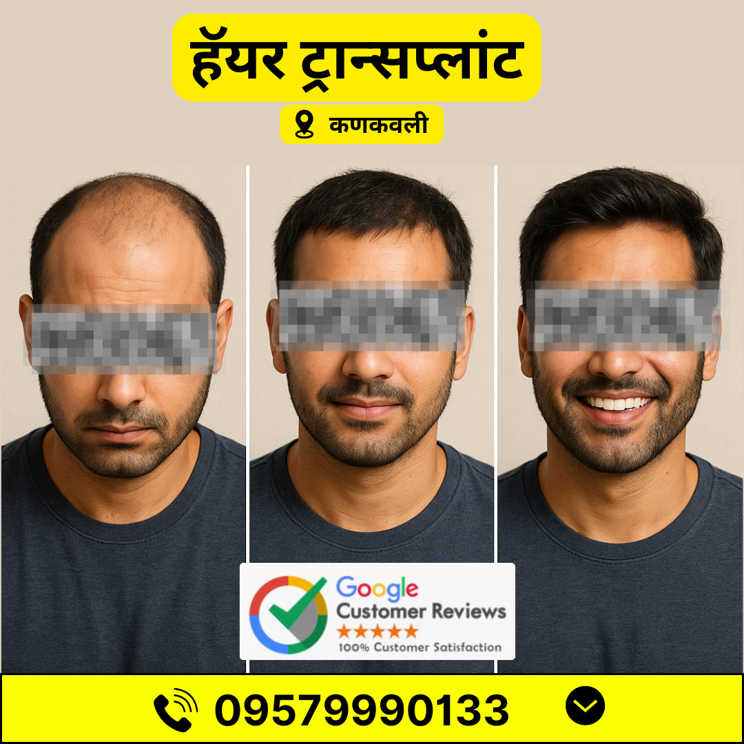 Getwell Hair transplant hospital Facebook ad from Jun 17, 2025