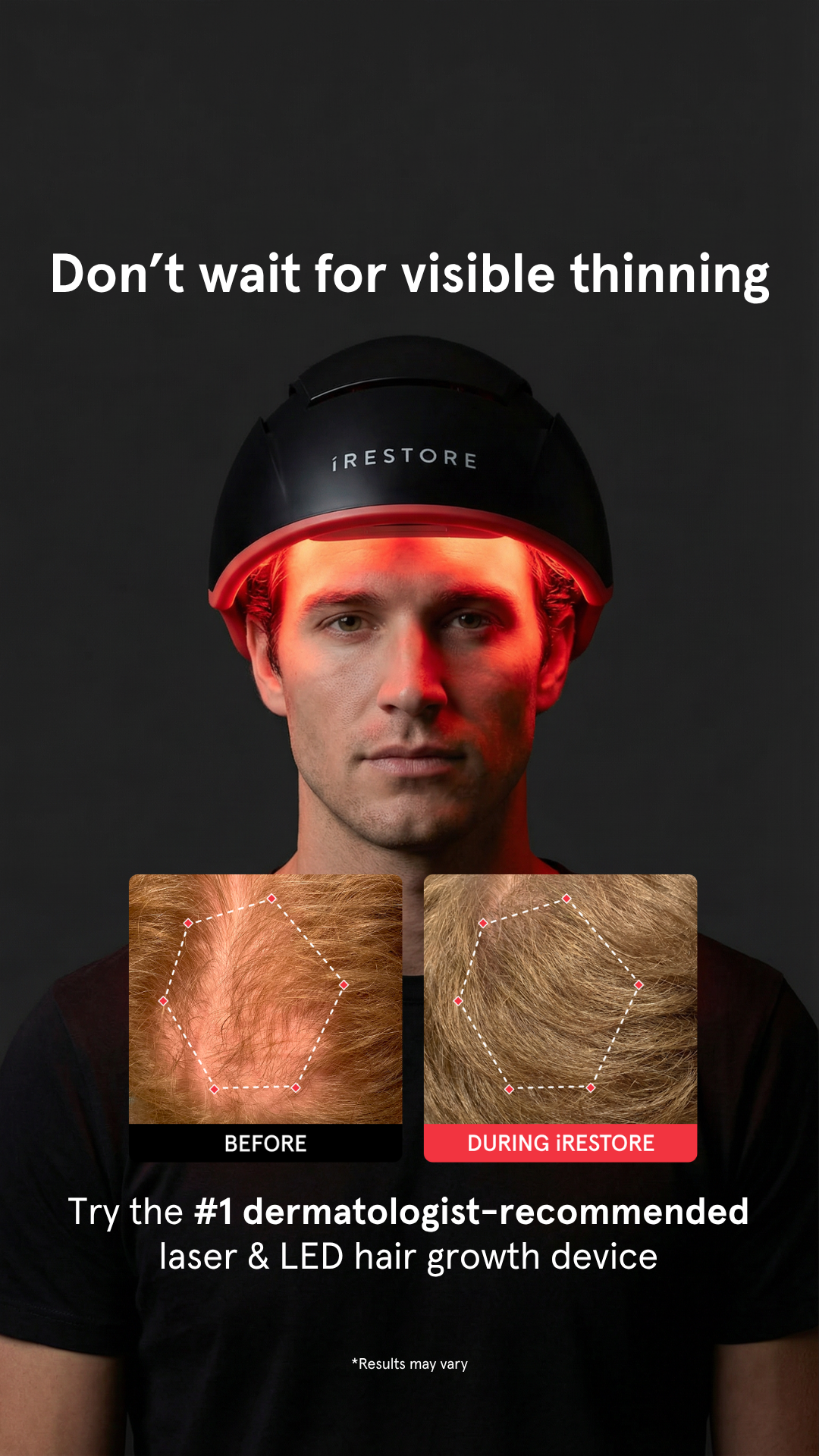 iRESTORE Hair Growth System Facebook ad from Aug 16, 2026