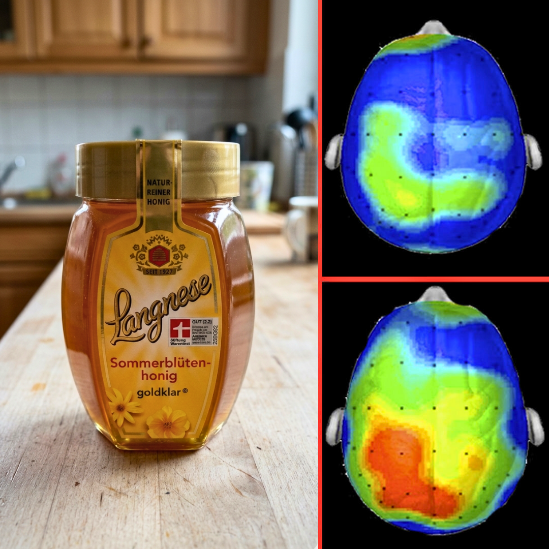 Sophia Evans Facebook ad: Alzheimer-Abbau verlangsamt, dank einer neuen Entdeckung…