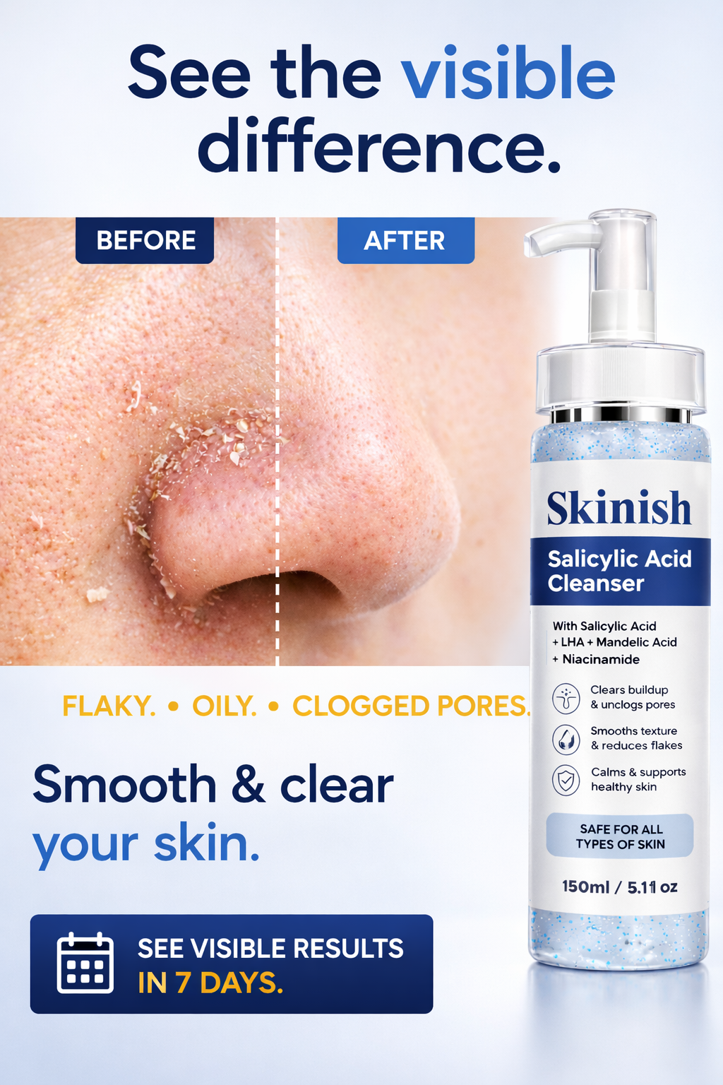 Skinish Facebook ad: Results in 7 days or your money back