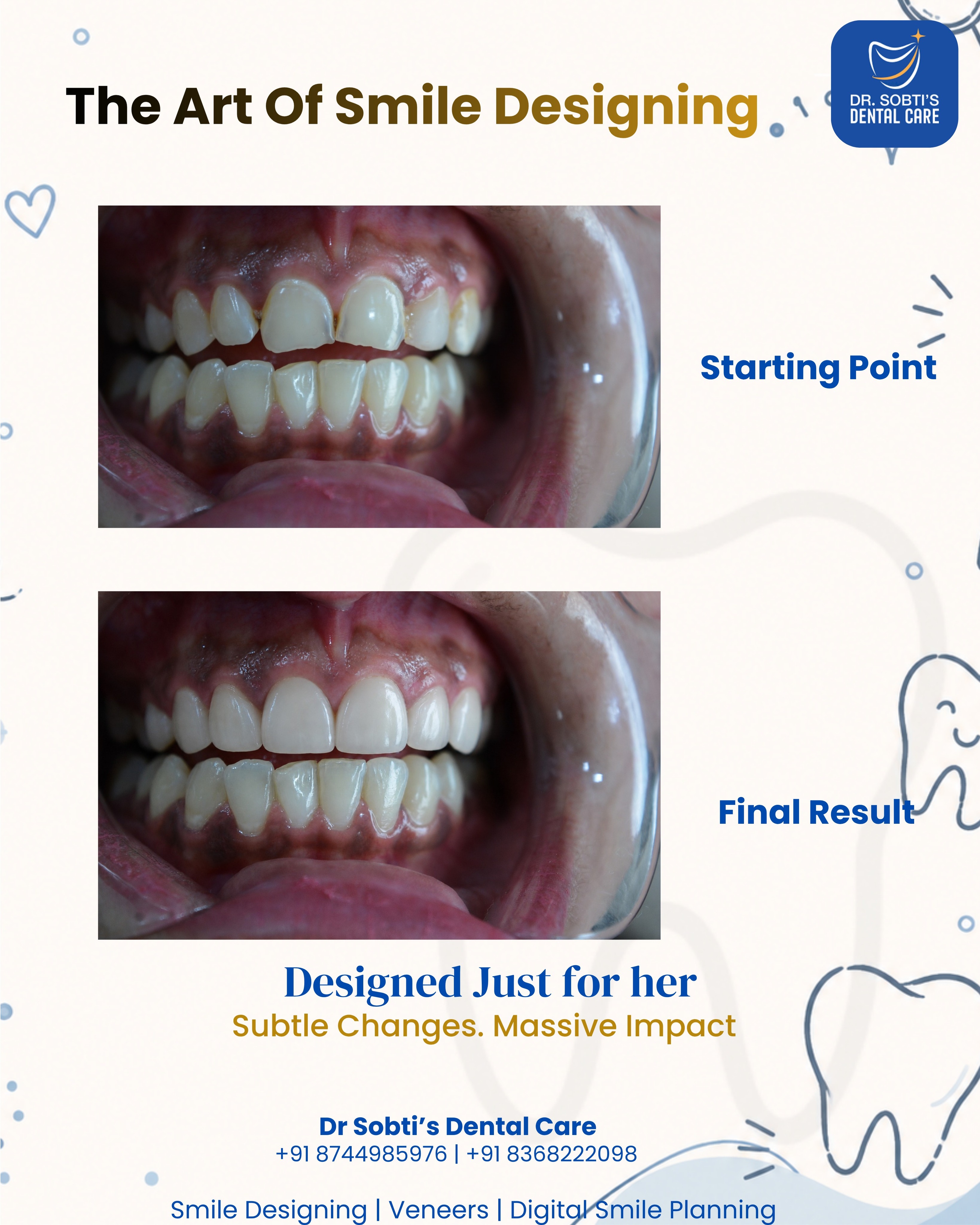 Dr Sobti's Dental Care Facebook ad: The most beautiful smile makeovers are the ones…