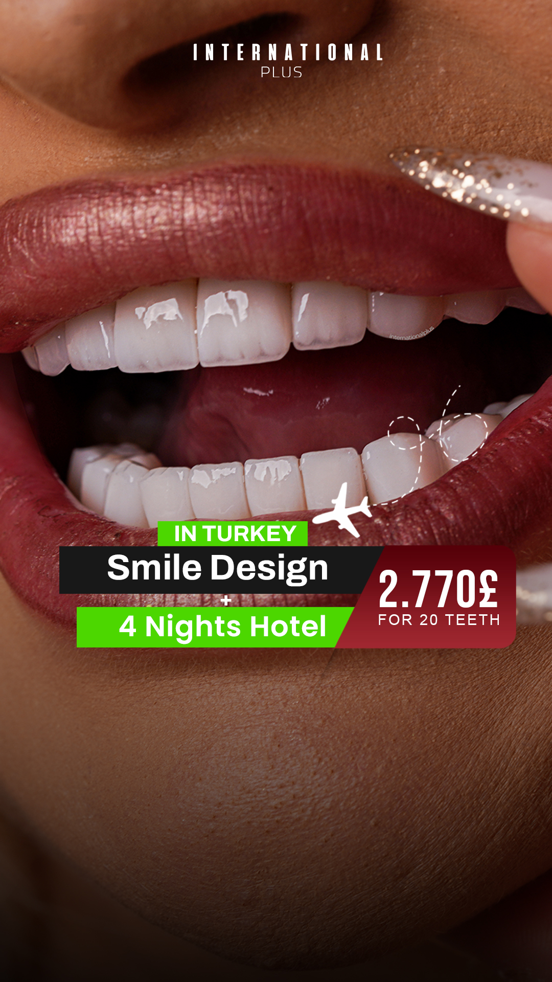 International Plus Dental Facebook ad from Apr 29, 2026