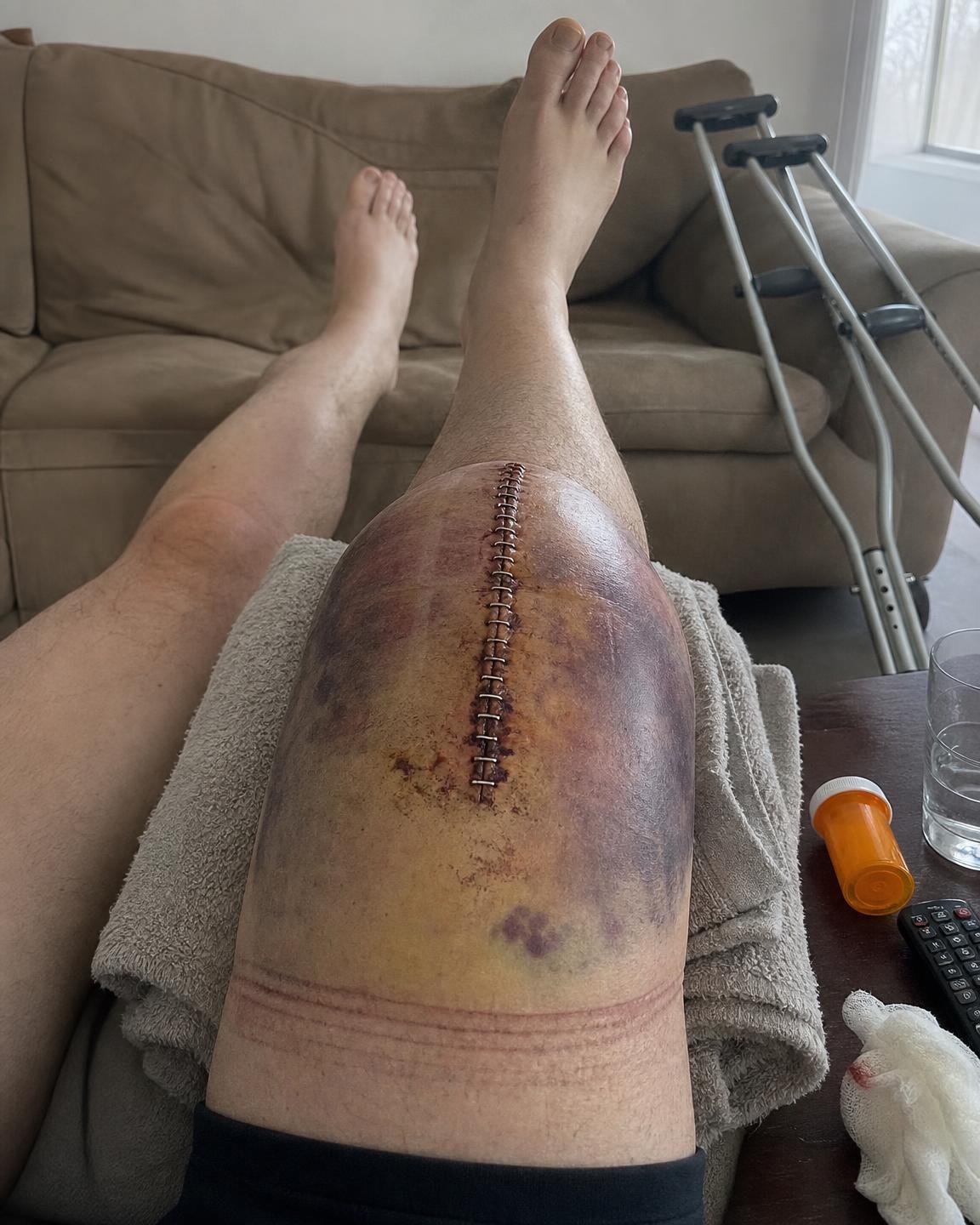 Linda Baker Facebook ad: 12 years of bone-on-bone knee pain gone in 2 days?