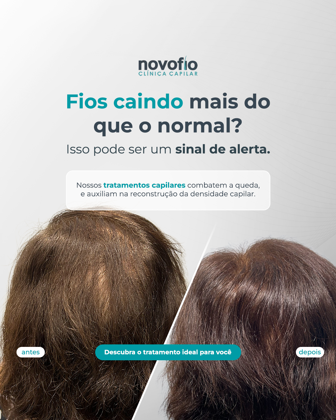 Novofio Presidente Prudente Clínica Capilar Facebook ad