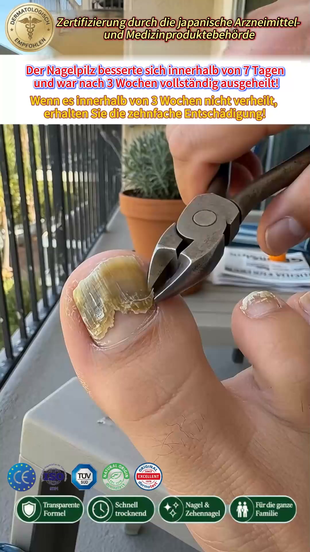 Bizzflowhub3 Facebook ad: Gelbe, dicke oder brüchige Nägel?