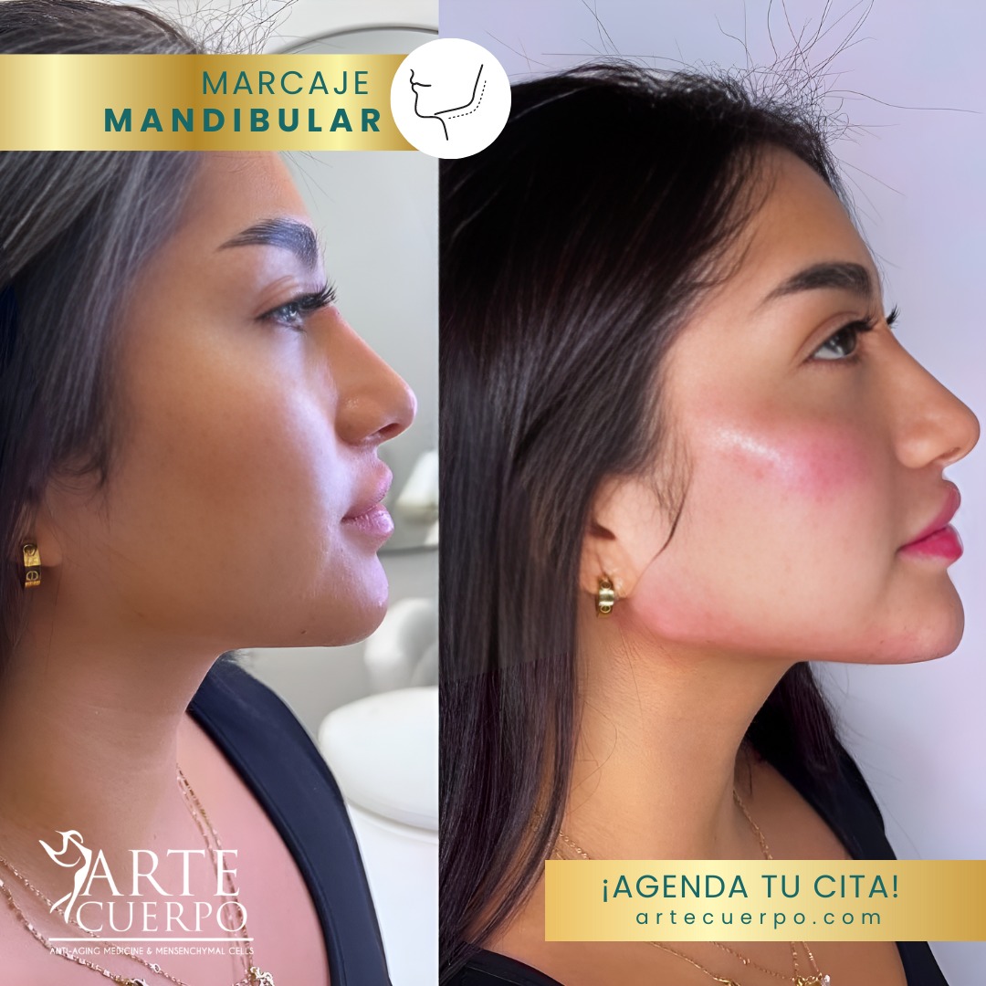 Clinica spa arte cuerpo  Facebook ad