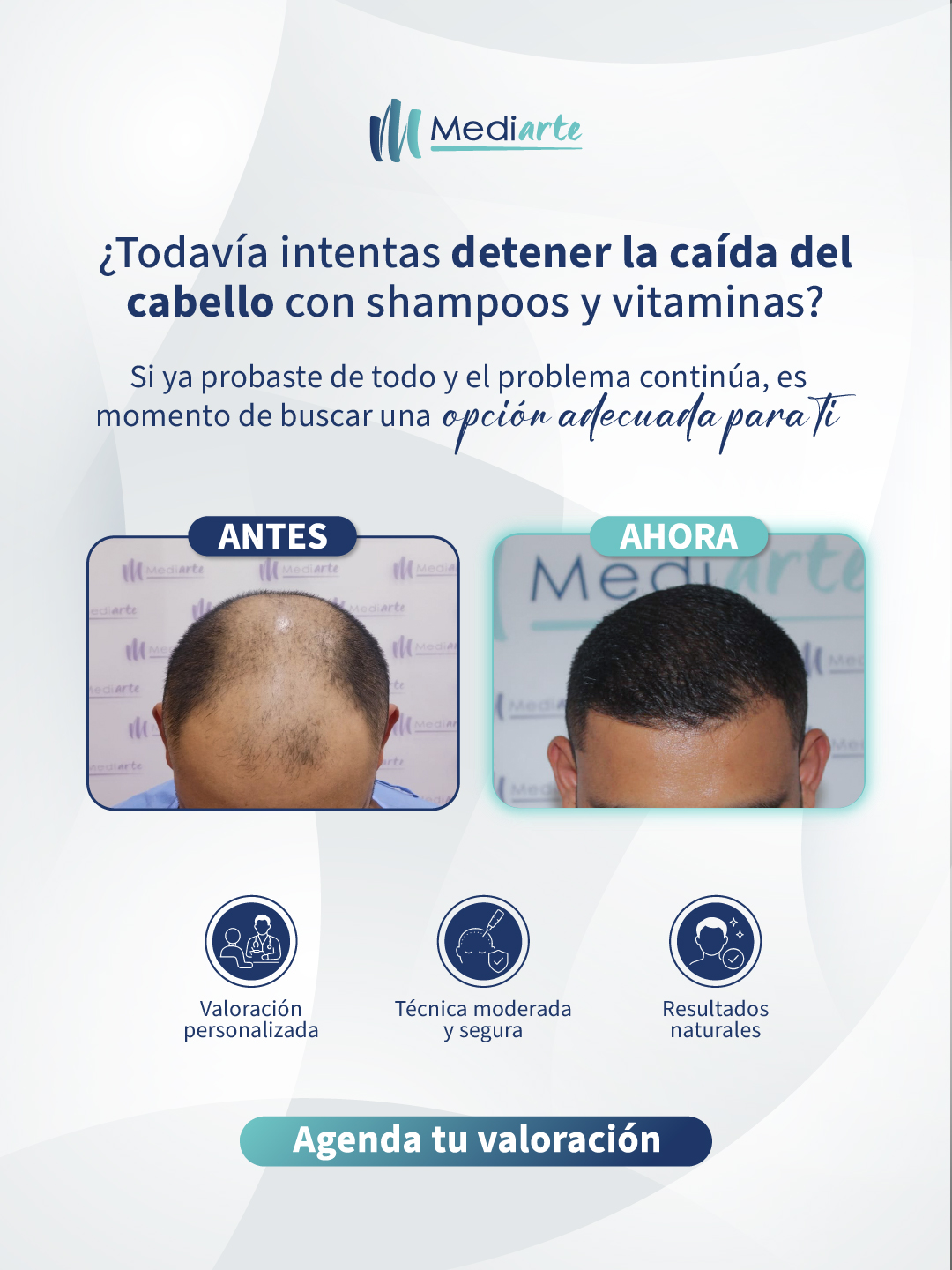 Mediarte Medical Center Facebook ad: ¿La caída del cabello continúa aunque hayas probado…
