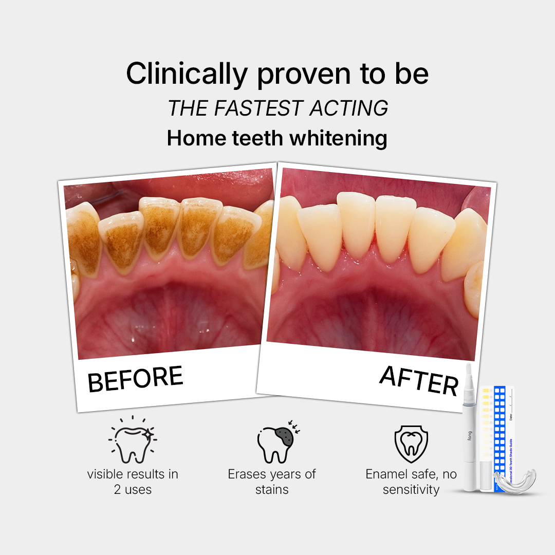 Smile Care Club Facebook ad
