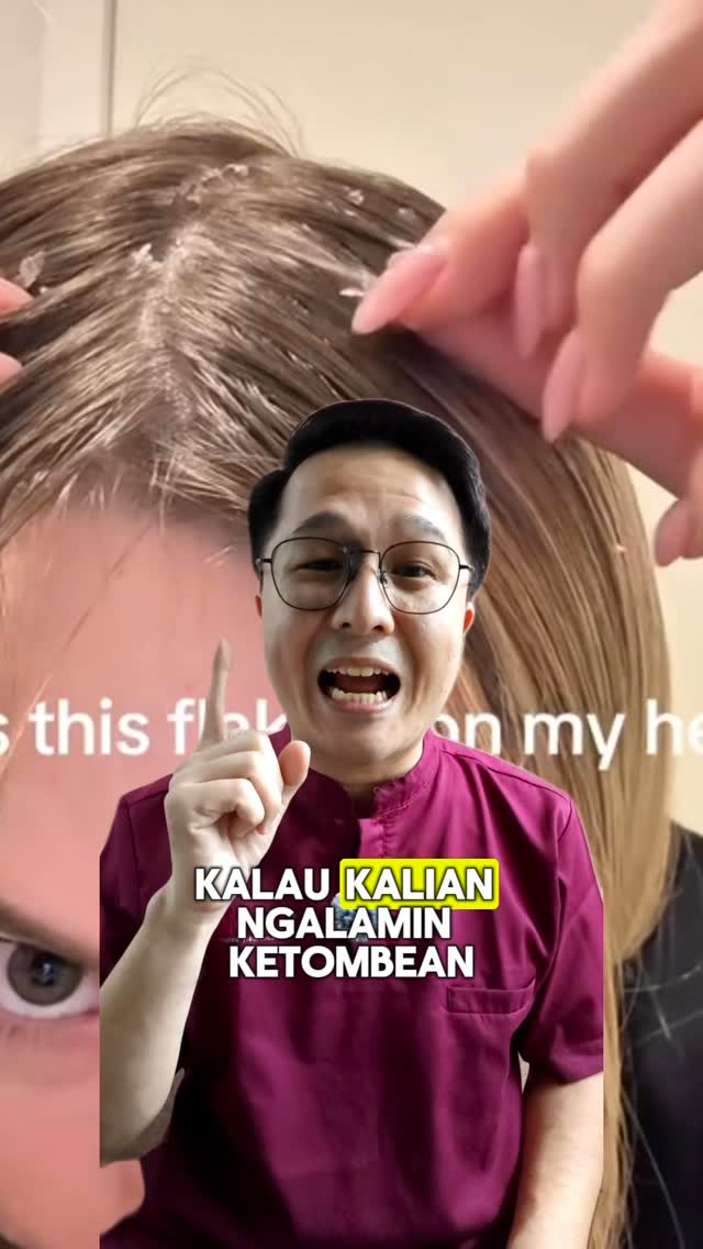 kevinbenlaurence Facebook ad: Ada yang ngalamin kepala berketombe seperti ini?