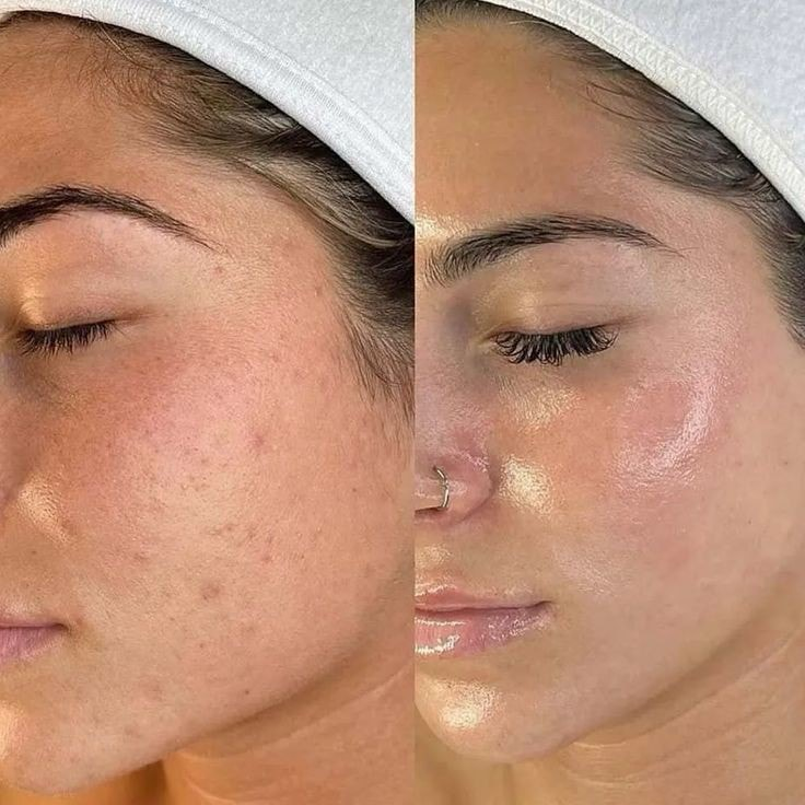 Illusion Spa Facebook ad: AGENDA TU CITA Y APROVECHA LA SÚPER PROMOCIÓN