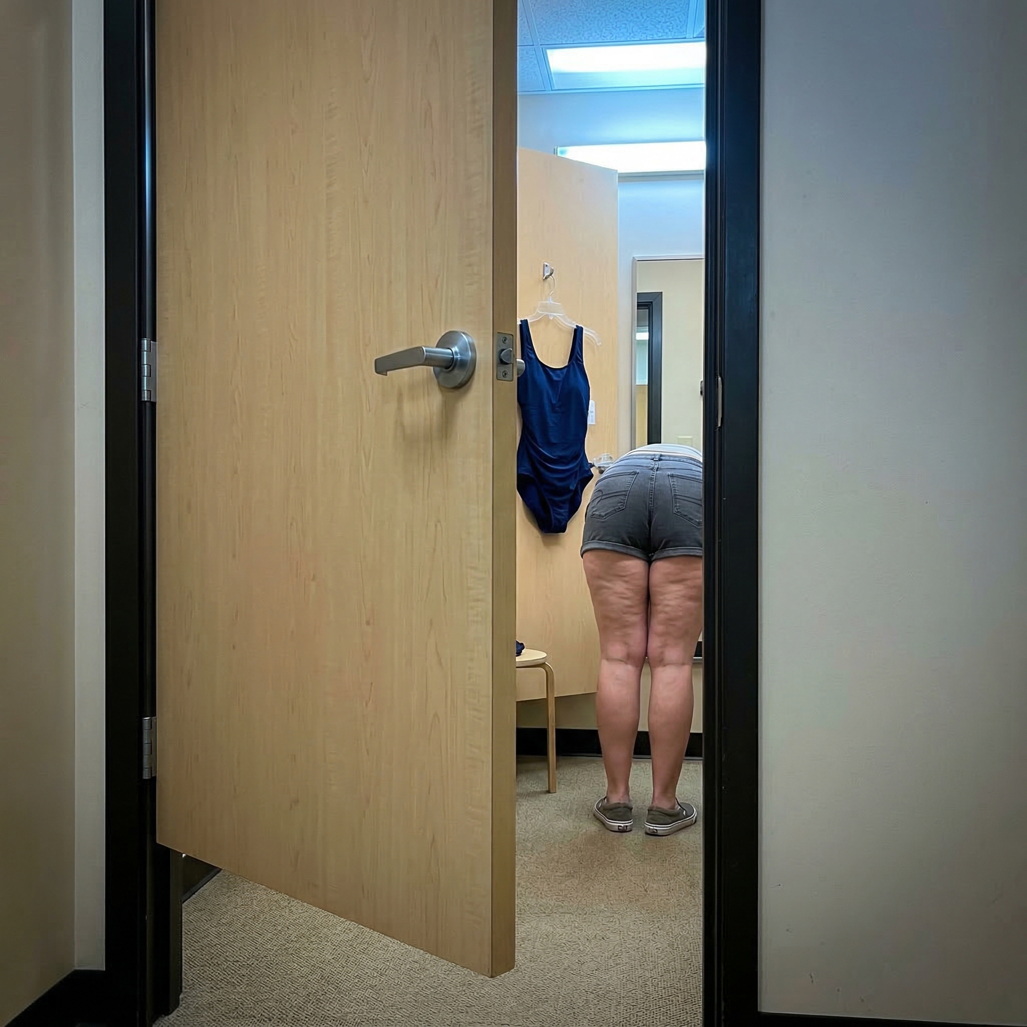 Susan Miller Facebook ad: I've Been Hiding My Legs For 3 Years.