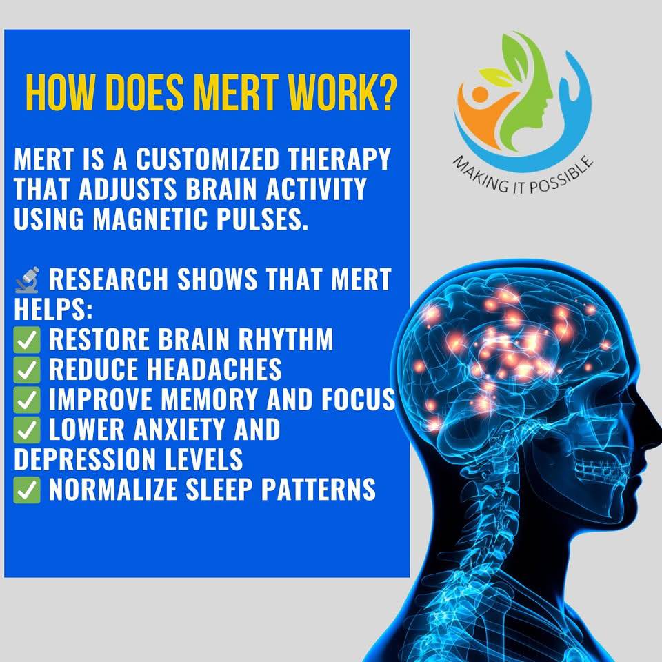 mip.mert Facebook ad: Try MeRT for your brain!