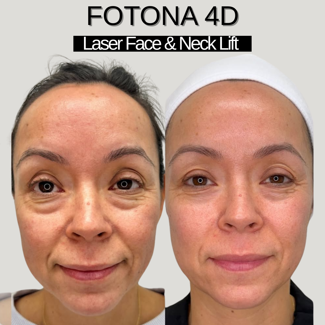 Enesima Facebook ad: TURN BACK THE CLOCK ON SAGGING SKIN REAL RESULTS, NO NEEDLES